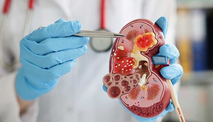 Nephrology Medical Billing Services