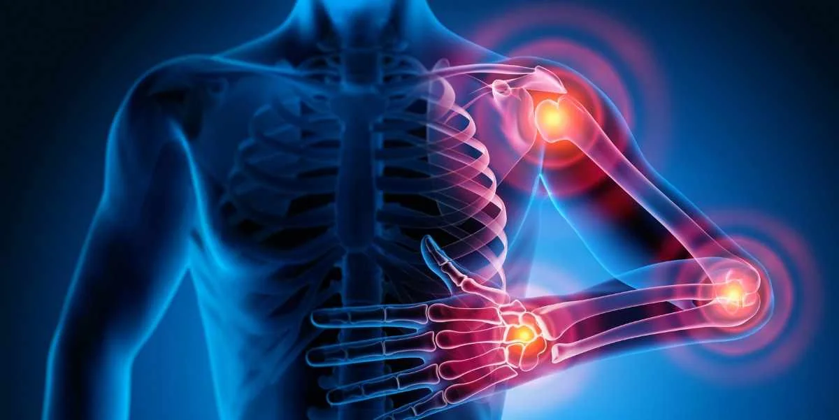 Rheumatology Medical Billing Services