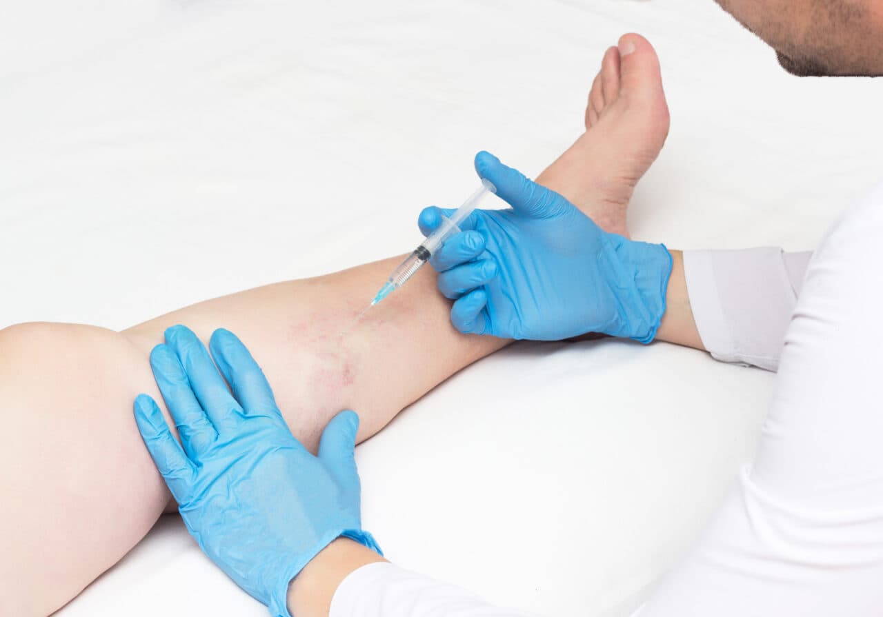 Vein Center Medical Billing Service